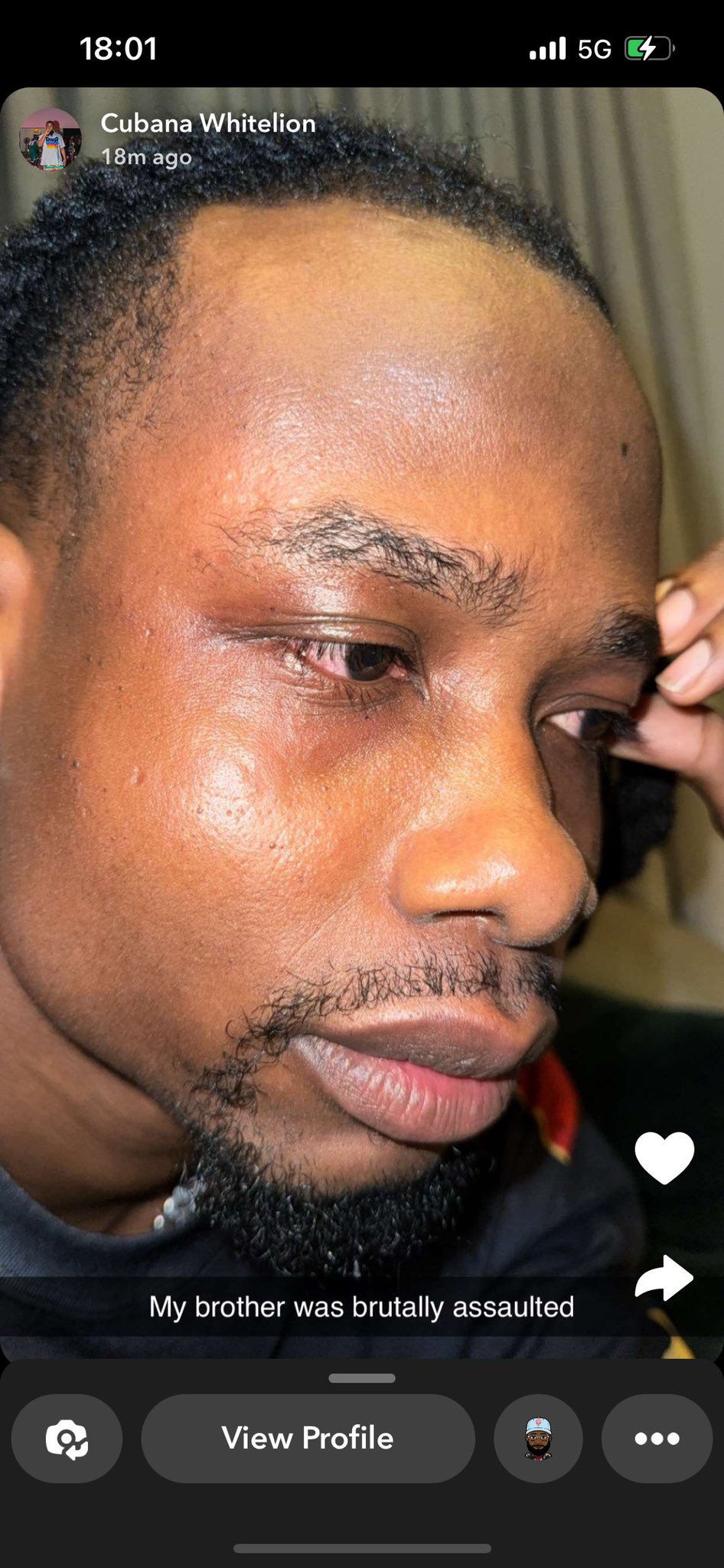 “He was assaulted by cultists” – Yhemolee’s best friend speaks on what transpired